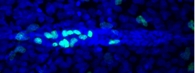 Zebrafish lateral line  BrdU