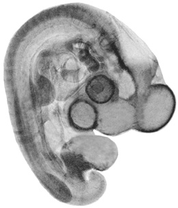 Stage 21 Chick Embryo